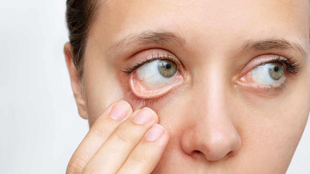 Lactoferrin supports IRON HEALTH, anemia