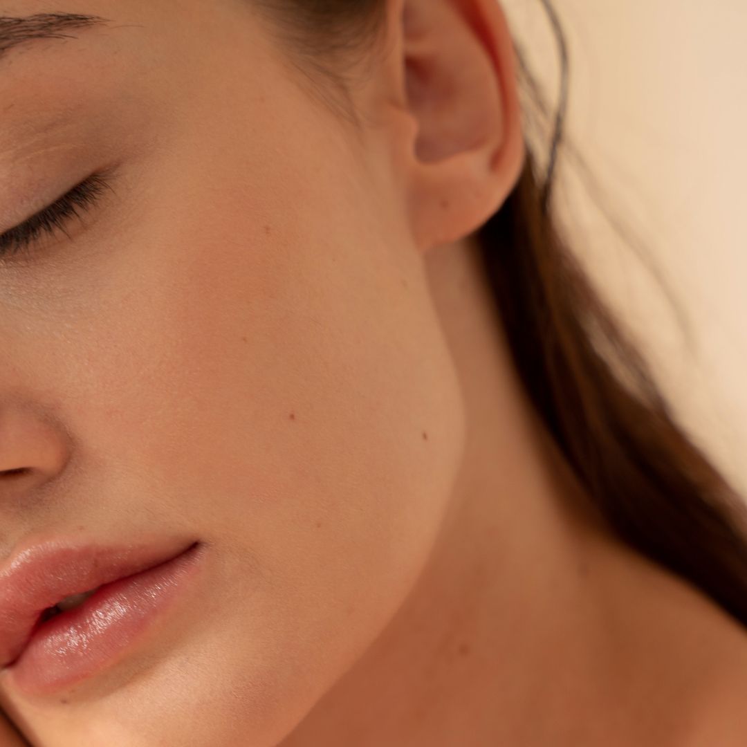 Your gut reflects on your skin